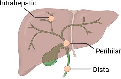 Intrahepatic cholangiocarcinoma: The role of liver transplantation, adjunctive treatments, and prognostic biomarkers